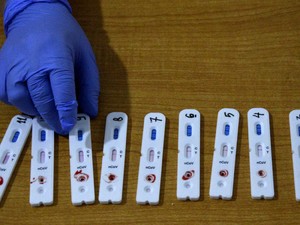 24 Warga Kebon Kacang Jakpus Positif Corona Hasil Rapid Test, Statusnya PDP