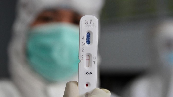 400 Orang Di Bali Reaktif Corona Setelah Jalani Rapid Test 400 Orang Di Bali Reaktif Corona Setelah Jalani Rapid Test