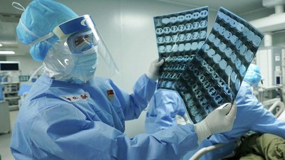 Yes! Pakar China Klaim Vaksin Corona Bisa Dipakai Awal Tahun Depan