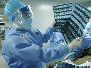 Tiga Vaksin Corona yang Dikembangkan China Masuki Tahap Uji Klinis