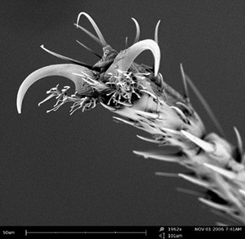 Kapur sampai Jus Jeruk, Penampakan yang Super Keren di Bawah Mikroskop