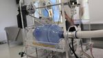 Cakep! RI Akhirnya Punya Ventilator Made in Bandung