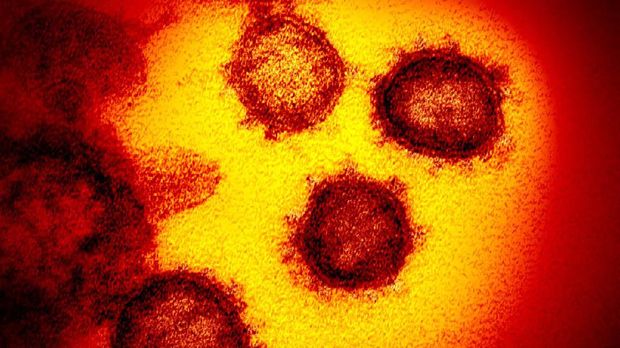 FILE - This undated electron microscope image made available by the U.S. National Institutes of Health in February 2020 shows the virus that causes COVID-19. (NIAID-RML via AP, File)