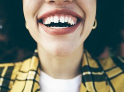 Wanita Ditangkap Polisi Karena Jasa Veneer Murah, Ternyata Pakai Lem Super