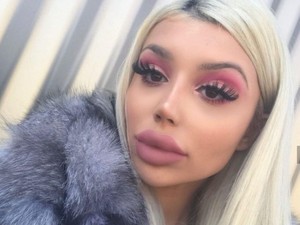 Dilarang ke Klinik Kecantikan, Wanita Ini Belajar Suntik Filler Sendiri di Rumah