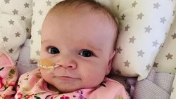 Erin Bates adalah putri berusia 6 bulan dari orang tua Emma dan Wayne, yang setelah menjalani operasi jantung besar dan didiagnosis positif Corona. Nasibnya?