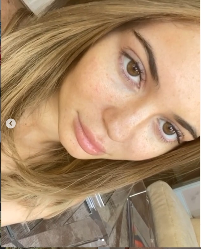 Tampil tanpa makeup, Kylie Jenner tampak memperlihatkan wajah aslinya yang dihiasi freckles. Bibirnya juga tidak setebal biasanya ketika diolesi lipstik. Foto: Instagram