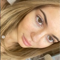 Tampil tanpa makeup, Kylie Jenner tampak memperlihatkan wajah aslinya yang dihiasi freckles. Bibirnya juga tidak setebal biasanya ketika diolesi lipstik. Foto: Instagram