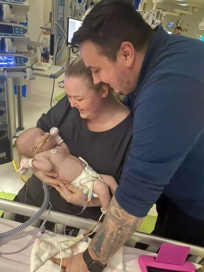 Erin Bates adalah putri berusia 6 bulan dari orang tua Emma dan Wayne, yang setelah menjalani operasi jantung besar, didiagnosis dengan virus Corona.