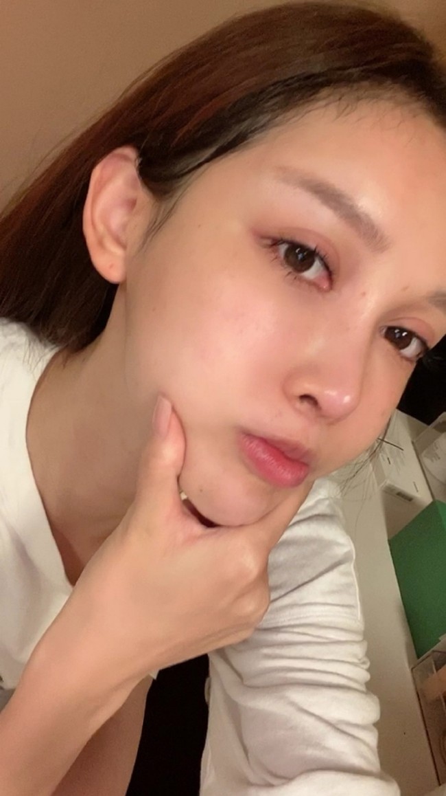 Jika ditotal, Abby sudah melakukan 100 kali prosedur dan menghabiskan  4 juta yuan atau sekitar Rp 8,6 miliar. Operasi pertama yang dilakukannya adalah liposuction di bagian paha ketika berusia 14 tahun. Ketika itu, Abby masih dibiayai oleh ibunya.Foto: dok. Weibo