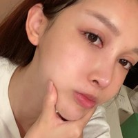 Jika ditotal, Abby sudah melakukan 100 kali prosedur dan menghabiskan  4 juta yuan atau sekitar Rp 8,6 miliar. Operasi pertama yang dilakukannya adalah liposuction di bagian paha ketika berusia 14 tahun. Ketika itu, Abby masih dibiayai oleh ibunya.Foto: dok. Weibo