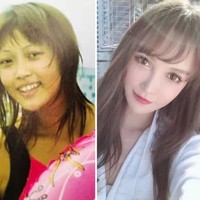 Aku tidak tahan dengan sedikit ketidaksempurnaan. Setiap bulan suntik untuk maintenance kulit, seperti hyaluronic acid atau suntik mengecilan wajah, dan setiap tahun aku melakukan satu operasi besar, kata wanita yang sering jadi model operasi plastik ini kepada Girl City.Foto: dok. Weibo