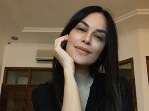 Viral Hasil Rontgen Sophia Latjuba, Cantiknya Sampai Tengkorak Wajah