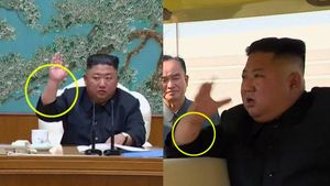 Tanda Bekas Operasi Kim Jong Un yang Masih Jadi Teka-teki