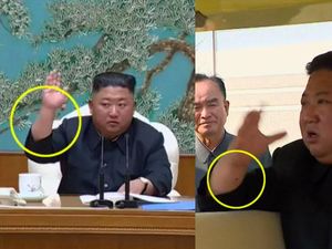 Tanda Bekas Operasi Kim Jong Un yang Masih Jadi Teka-teki