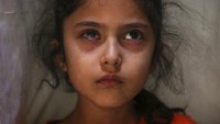 Anak kecil korban penembakan paramiliter India, Muneefa Nazir difoto oleh Mukhtar Khan, (12/9/2019). Foto karya Mukhtar Khan ini merupakan satu foto dari rangkaian foto feature yang menjadi pemenang kategori Feature Photography. AP Photo/Mukhtar Khan.