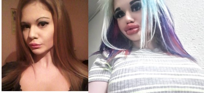 Padahal sebelum melakukan tindakan kecantikan, penampilan Andrea terlihat lebih cantik. Ia memiliki bibir asli yang tipis.  Foto: dok. Instagram