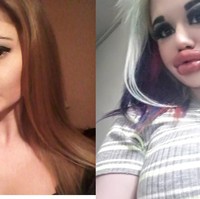 Padahal sebelum melakukan tindakan kecantikan, penampilan Andrea terlihat lebih cantik. Ia memiliki bibir asli yang tipis.  Foto: dok. Instagram