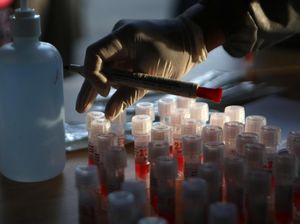 WHO Ubah Syarat Akhiri Isolasi Pasien Corona, Tak Harus 2 Kali Negatif PCR