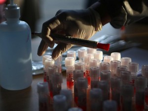 Teman Dekat atau Keluarga Positif COVID-19? Ini yang Wajib Dilakukan