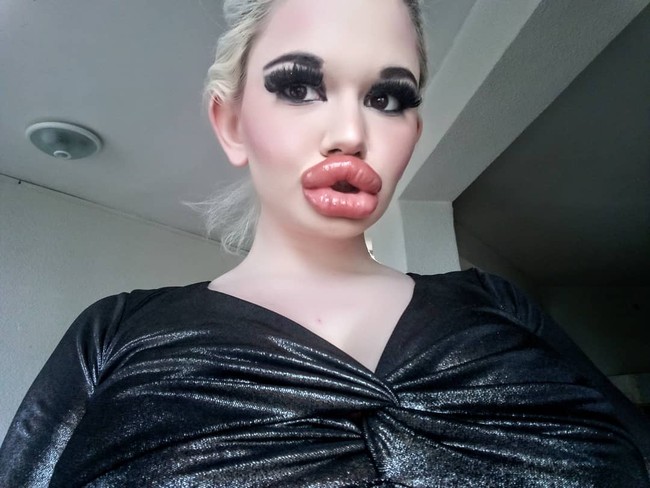 Andrea Ivanova sempat jadi viral karena ukuran bibirnya yang tidak wajar. Wanita asal Bulgaria itu punya bibir super besar dan bervolume. Ia pun terobsesi ingin punya bibir terbesar di dunia. Foto: dok. Instagram