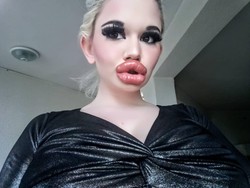 Wanita dengan Bibir Terbesar di Dunia Kecanduan Filler, Ini Penampilannya Dulu Wanita dengan Bibir Terbesar di Dunia Kecanduan Filler, Ini Penampilannya Dulu