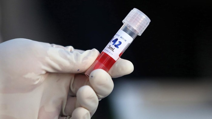 Jakarta Terima 100 Ribu Alat Rapid Test Corona Ini Warga Yang