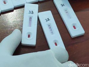 70 Pegawai Kelurahan dan Kecamatan Sukolilo Surabaya Rapid Test, 18 Reaktif
