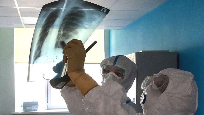 Virus corona: Terobosan baru memeriksa paru-paru pasien Covid-19 dengan kecerdasan buatan Virus corona: Terobosan baru memeriksa paru-paru pasien Covid-19 dengan kecerdasan buatan