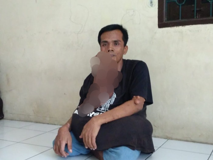 Sakit misterius pria di Medan (Datuk Haris Molana-detikcom)