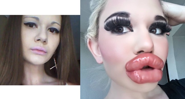 Penampilannya yang dulu juga terlihat lebih imut. Andrea tampak ingin bertransformasi besar-besar pada penampilannya. Selain membesarkan bibir, ia tampaknya juga melakukan implan payudara dan selalu menggunakan bulu mata palsu super tebal. Foto: dok. Instagram