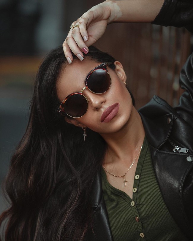 Tak hanya itu, Paulett juga kerap menyebar semangat positif dengan merangkul kekurangan yang dimilikinya di postingan Instagram. Hal tersebut membuat dirinya dikagumi. Foto: Instagram