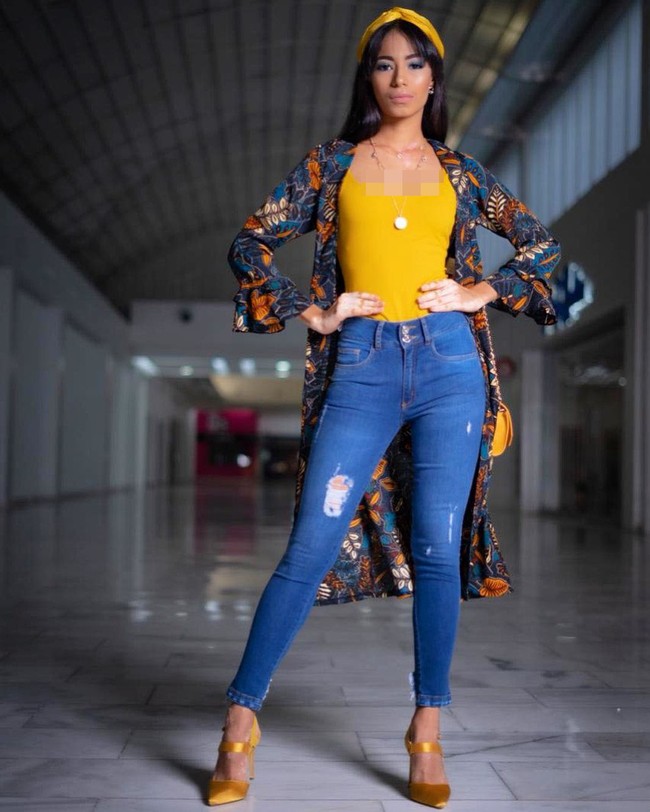 Namun, perjalanan kariernya di kontes kecantikan tak mulus. Kariernya sempat terhenti lantaran kelainan yang dideritanya. Foto: Instagram