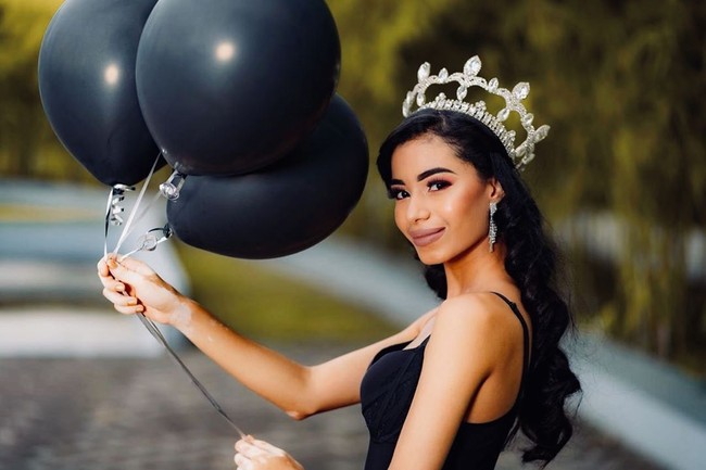  Paulett pernah terpilih untuk mewakili negaranya dalam kontes kecantikan yang berlangsung di Malaysia pada 2018 lalu, namun ia dipecat oleh presiden penyelenggara kontes karena penyakit vitiligonya. Foto: Instagram