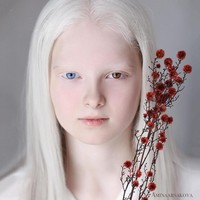 Amina Ependieva adalah salah satu bukti bahwa ketidaksempurnaan tidak selalu buruk. Nyatanya dengan kekurangan yang dimilikinya, Ependieva justru terlihat cantik dan menarik. Bagaimana menurutmu? Foto: Instagram @aminaarsakova