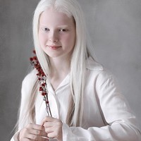 Gadis cantik bernama Amina Ependieva itu berasal dari sebuah desa di Kurchaloy, Rusia. Ependieva memiliki kondisi albino dan heterochromia. Albino adalah kondisi kulit tanpa pigmentasi sehingga seluruh kulit hingga rambutnya berwarna putih, sedangkan heterochromia adalah perbedaan warna dalam iris mata. Foto: Instagram @aminaarsakova