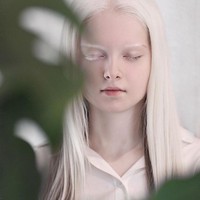 Seperti dikutip dari Oddity Central, foto-foto Ependieva menjadi viral setelah dibagikan oleh fotografer terkenal yang memotretnya, Amina Arsakova di Instagram. Hingga kini, foto-fotonya tersebut telah mendapatkan lebih dari 10 ribu likes. Foto: Instagram @aminaarsakova