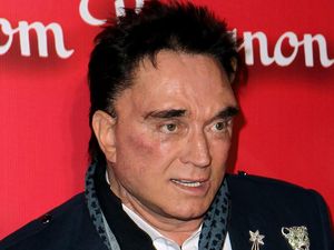Ilusionis Roy Horn Siegfried & Roy Meninggal Akibat Corona