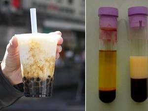 Minum Bubble Tea 6 Bulan, Warna Plasma Darah Pria Ini Jadi Putih Susu!