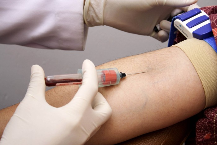 Prodia menyediakan pemeriksaan SARS-CoV-2 RNA dengan metode real-time RT-PCR (PCR COVID-19) yang mendeteksi 3 (tiga) target gen sekaligus yaitu Gen E, N, dan RdRP sesuai dengan protokol yang ditetapkan World Health Organization (WHO)