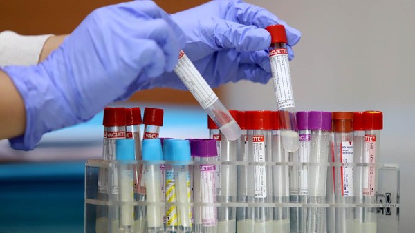 Test PCR Deteksi 3 Gen Sekaligus