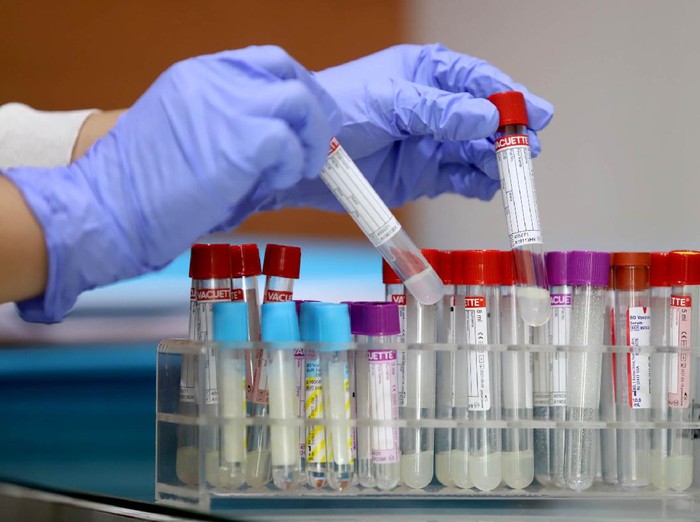 Prodia menyediakan pemeriksaan SARS-CoV-2 RNA dengan metode real-time RT-PCR (PCR COVID-19) yang mendeteksi 3 (tiga) target gen sekaligus yaitu Gen E, N, dan RdRP sesuai dengan protokol yang ditetapkan World Health Organization (WHO)