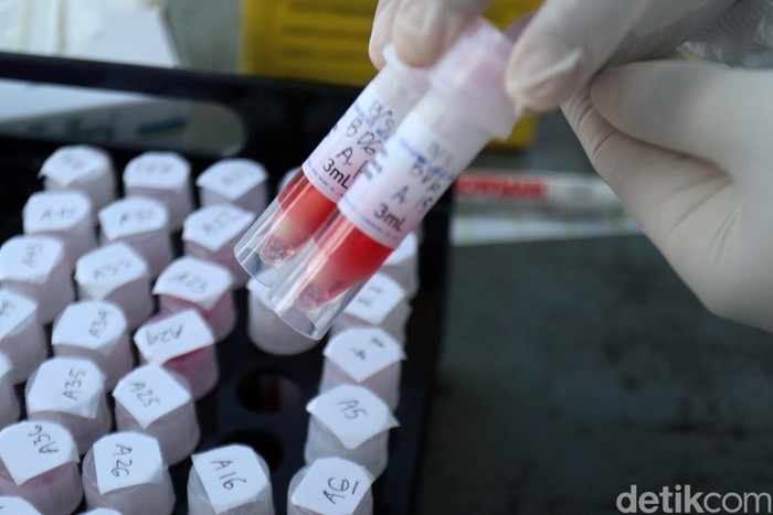 Tes swab terus digalakkan untuk mendeteksi virus Corona (COVID-19). Begini tahapan tes swab COVID-19 di Terminal Cicaheum, Kota Bandung, Rabu (13/5).