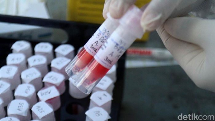 Melihat Proses Tes Swab Corona di Terminal Cicaheum Tes swab terus digalakkan untuk mendeteksi virus Corona (COVID-19). Begini tahapan tes swab COVID-19 di Terminal Cicaheum, Kota Bandung, Rabu (13/5).