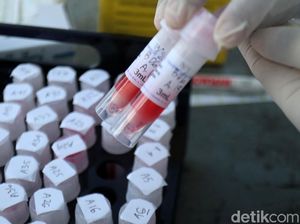 Pemerintah Yakin 10 Ribu Spesimen Per Hari Masih Bisa Ditingkatkan Lagi