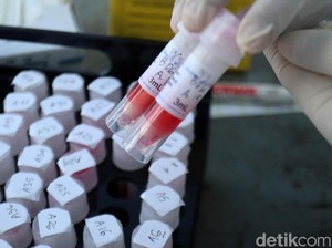 Data Terbaru COVID-19 di Bandung, Positif Corona Kini 279 Orang