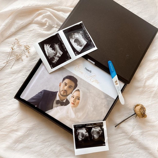 Sabrina Sosiawan dan Adhiguna menikah dengan adat Sunda pada 26 Agustus 2019. Setelah menikah, keduanya memutuskan untuk berbulan madu ke beberapa negara, seperti Prancis, Swiss dan Jerman. Dalam instagramnya @adhigunasosiawan, Adhiguna membagikan kabar kehamilan pertama Sabrina pada 22 Maret 2020. Foto: instagram @sabrinasosiawan