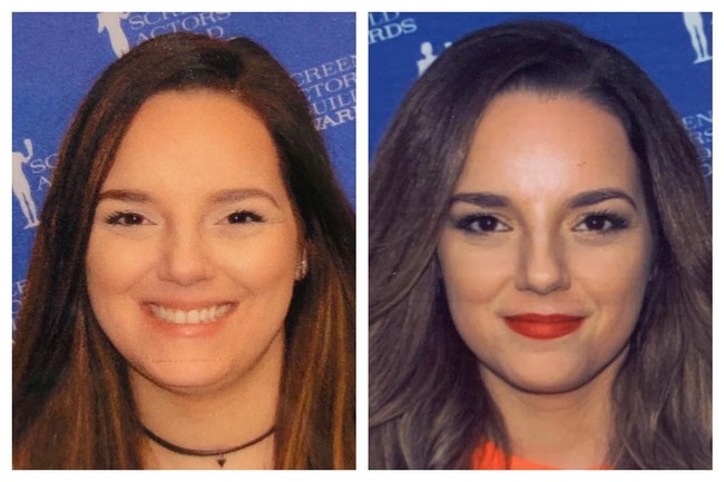 Selain jadi lebih langsing dan sehat, diet keto juga mengubah wajahnya menjadi semakin cantik dalam kurun waktu satu tahun. Foto: Instagram @dayduh