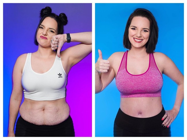 Selain itu, Dayna pun mengakui bahwa ia melakukan berbagai perawatan untuk terlihat lebih cantik, seperti tummy tuck, breast lift, breast implants, fat transfer, hingga liposuction demi membentuk tubuh ideal.Foto: Instagram @dayduh