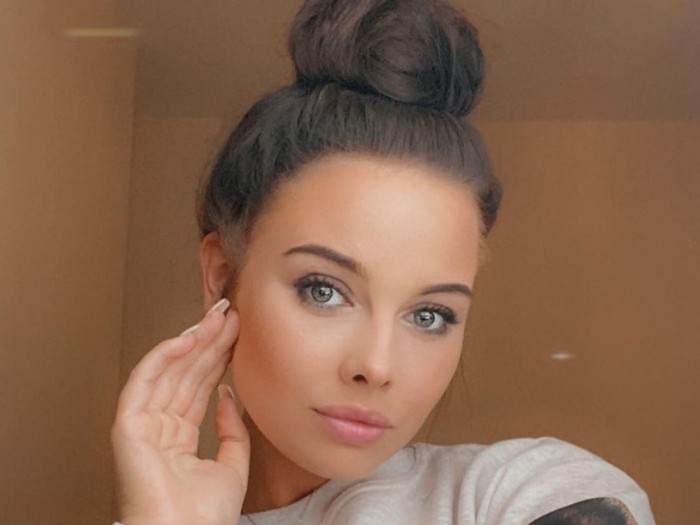Kym Graham Kym Graham, model yang kulitnya rusak karena produk tanning meledak.